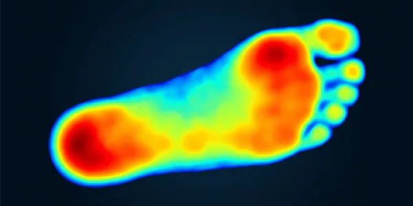 Before — pressure concentrated on heel