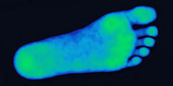 After — pressure distributed across full foot
